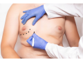 resolve-the-issues-of-enlarged-male-breasts-with-gynecomastia-surgery-dubai-small-0