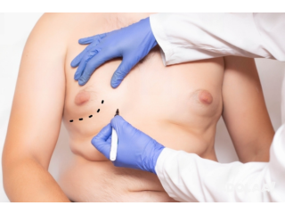 Resolve the issues of enlarged male breasts with gynecomastia surgery dubai