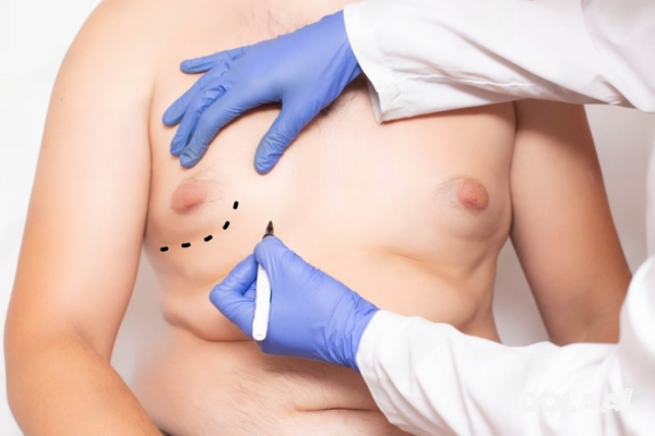 resolve-the-issues-of-enlarged-male-breasts-with-gynecomastia-surgery-dubai-big-0