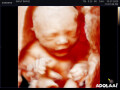 discover-your-babys-gender-and-experience-live-4d5d-realistic-vuescan-with-exceptional-savings-small-0