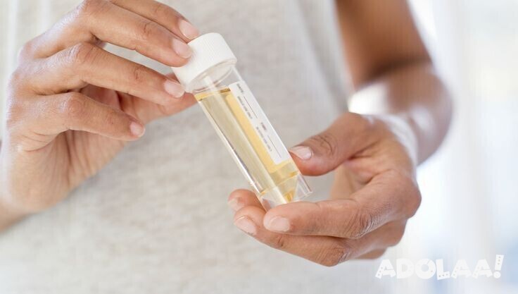 how-to-know-if-you-have-kidney-stones-big-0