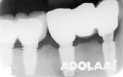 emergency-dentist-in-balwyn-north-big-0