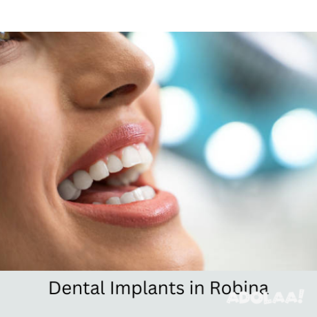 hire-dental-implants-in-robina-big-0