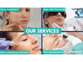 experience-top-notch-laser-care-at-oxyderm-clinic-small-0