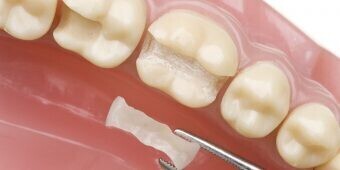 dentist-open-on-weekends-big-0