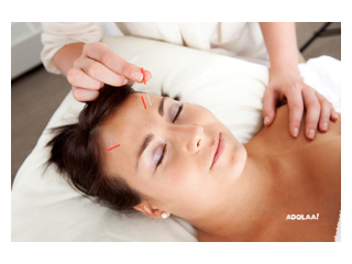 Get Experience the Power of Acupuncture in London