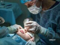 best-retina-surgery-in-noida-small-0