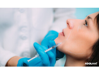 Dermal Fillers Treatment in Ludhiana