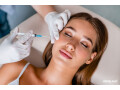 surgery-for-acne-at-the-skin-smiths-clinic-small-0