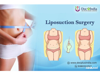 Affordable Liposuction Surgery In Hyderabad At Docplus India