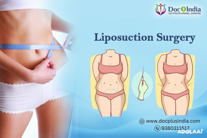affordable-liposuction-surgery-in-hyderabad-at-docplus-india-big-0