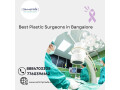 best-plastic-surgeons-in-bangalore-small-0