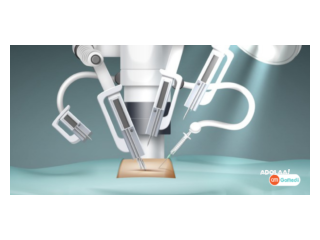 Indian Affordable Robotic Surgery Treatment