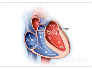 Best Pacemaker Implantation Surgery In India