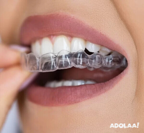 invisible-orthodontics-in-shyamal-big-0