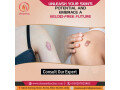 charma-skin-laser-clinic-laser-skin-care-centre-in-purnia-bihar-small-4