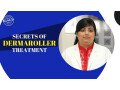 doctor-for-dermaroller-treatment-in-delhi-small-0