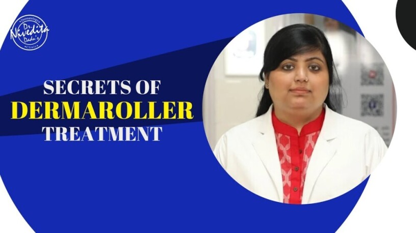 doctor-for-dermaroller-treatment-in-delhi-big-0