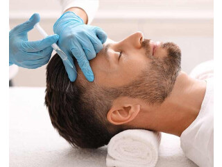 Best Hair Transplant in Delhi