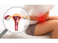 top-rated-endometriosis-specialist-in-ahmedabad-small-0