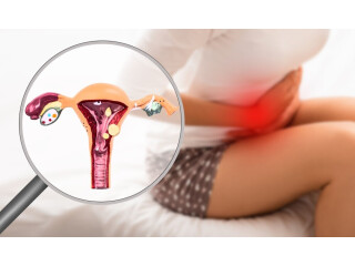 Top Rated Endometriosis Specialist in Ahmedabad