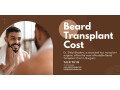 beard-transplant-cost-in-gurgaon-small-0