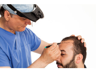 Hair Transplant cost in Bangalore