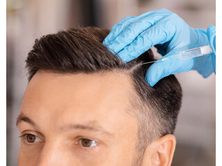 Hair Restoration Treatment In Gurgaon