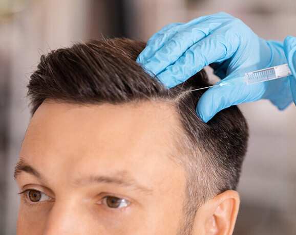 hair-restoration-treatment-in-gurgaon-big-0