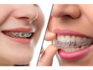 Orthodontist in Mansarovar Jaipur