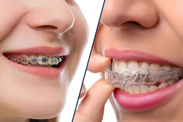 orthodontist-in-mansarovar-jaipur-big-0