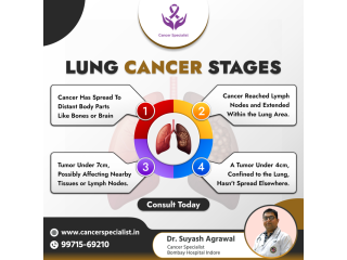 Dr. Suyash Agrawal: Cancer Doctor Indore