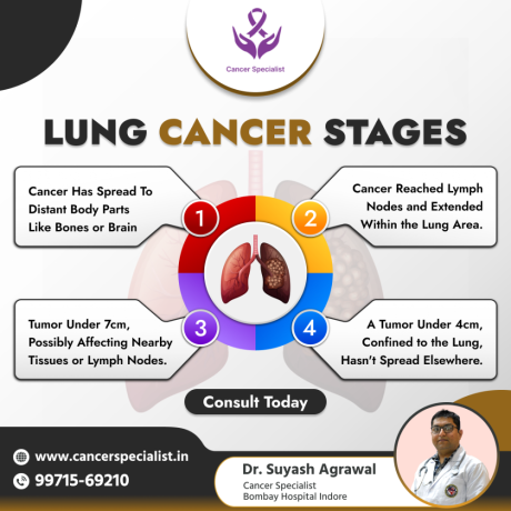 dr-suyash-agrawal-cancer-doctor-indore-big-0