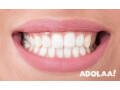 pearls-of-wisdom-navigating-oral-health-small-0