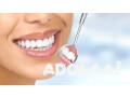 dental-care-for-kids-a-parents-guide-to-happy-smiles-small-0