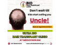 best-hair-transplant-in-chennai-small-0