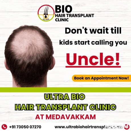 best-hair-transplant-in-chennai-big-0