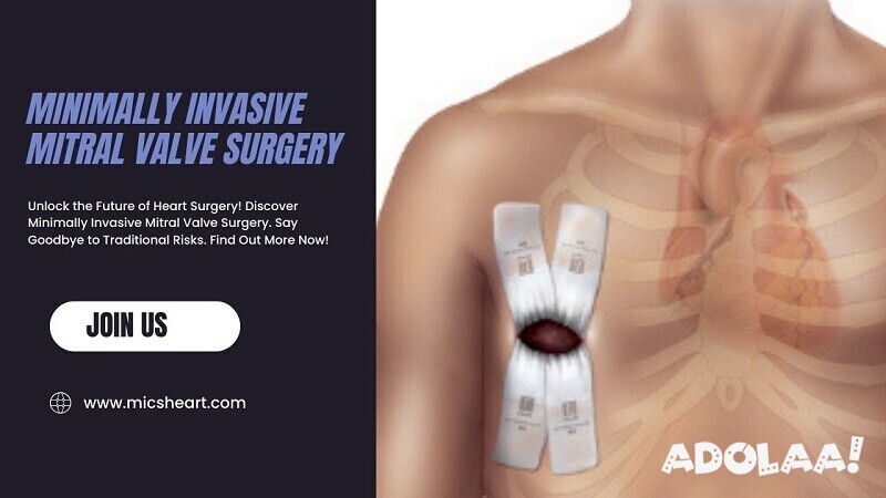 minimally-invasive-mitral-valve-surgery-big-0