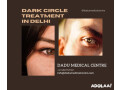 dark-circle-treatment-in-delhi-small-0