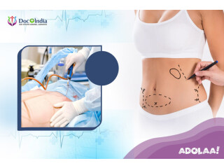 Liposuction Surgery Cost In Hyderabad at Docplusindia