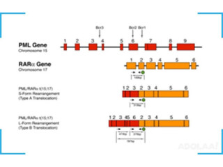 PML RARA PCR Kit | PML RARA RT PCR Kit | PML RARA quantitative kit