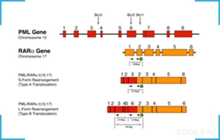 pml-rara-pcr-kit-pml-rara-rt-pcr-kit-pml-rara-quantitative-kit-big-0