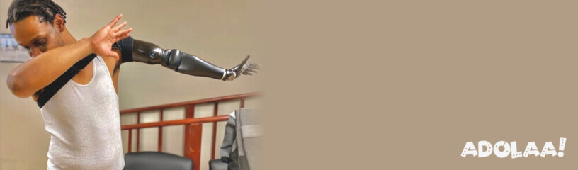 empower-movement-advanced-shoulder-prosthetic-parts-by-bionic-india-big-0