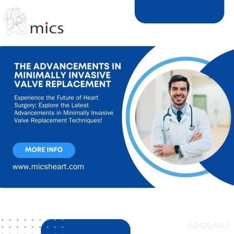 the-advancements-in-minimally-invasive-valve-replacement-big-0