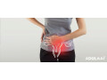pcod-treatment-in-mumbai-small-0