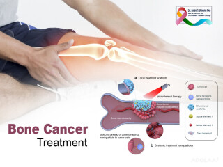 Best Bone Cancer treatment in Hyderabad-Drksrinivascancercare