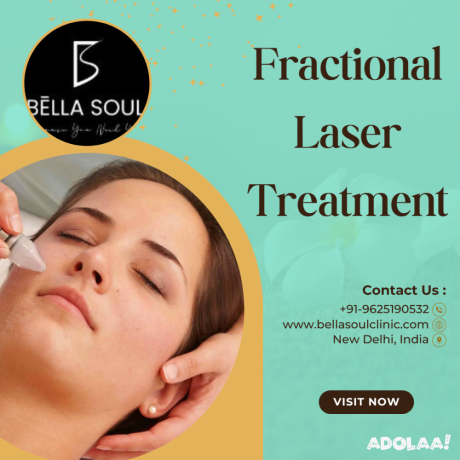 best-fractional-laser-treatment-delhi-big-0