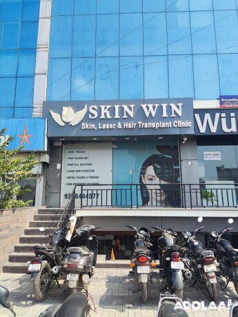 skin-win-skin-laser-and-hair-transplant-clinic-big-2