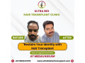 hair-treatment-in-chennai-small-1