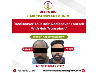 Hair treatment in chennai